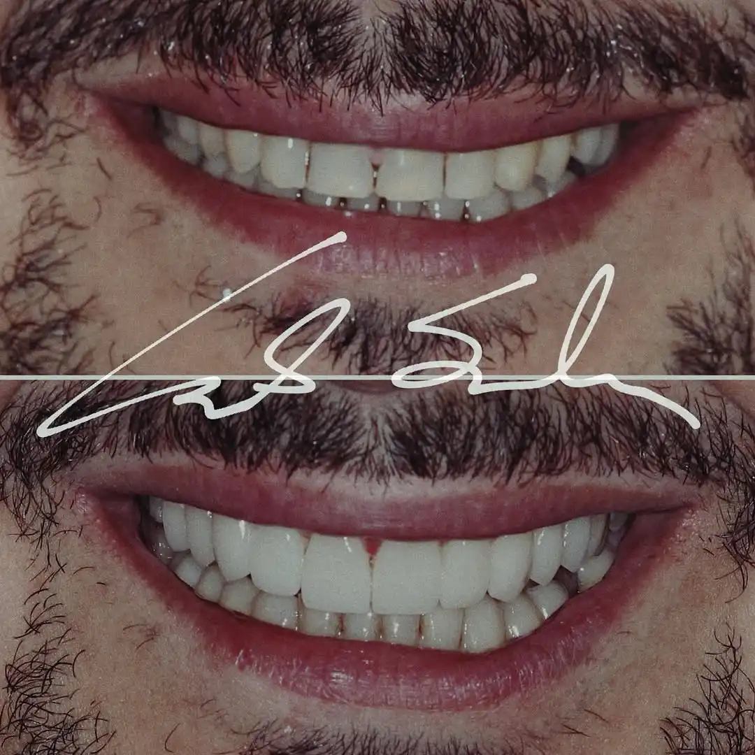 Transformação de Sorriso Dr Carlos Scherer