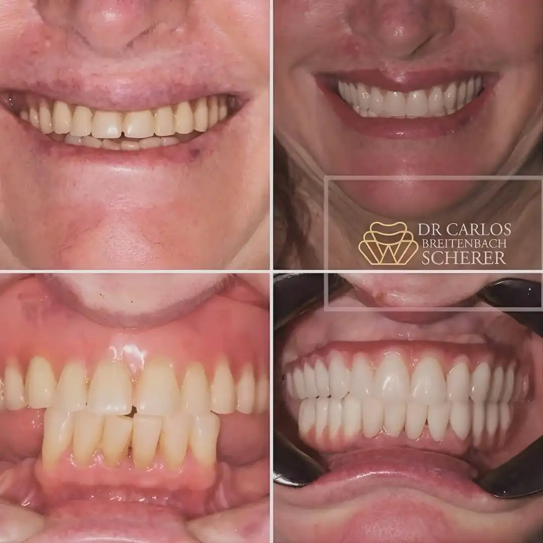 Paciente satisfeito após tratamento de reabilitação oral em Passo Fundo