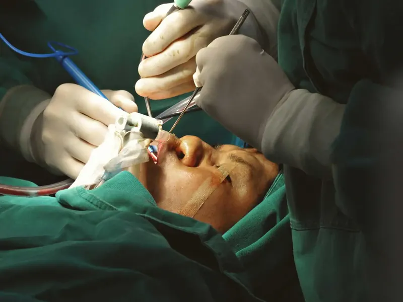 Cirurgias Odontológicas Avançadas