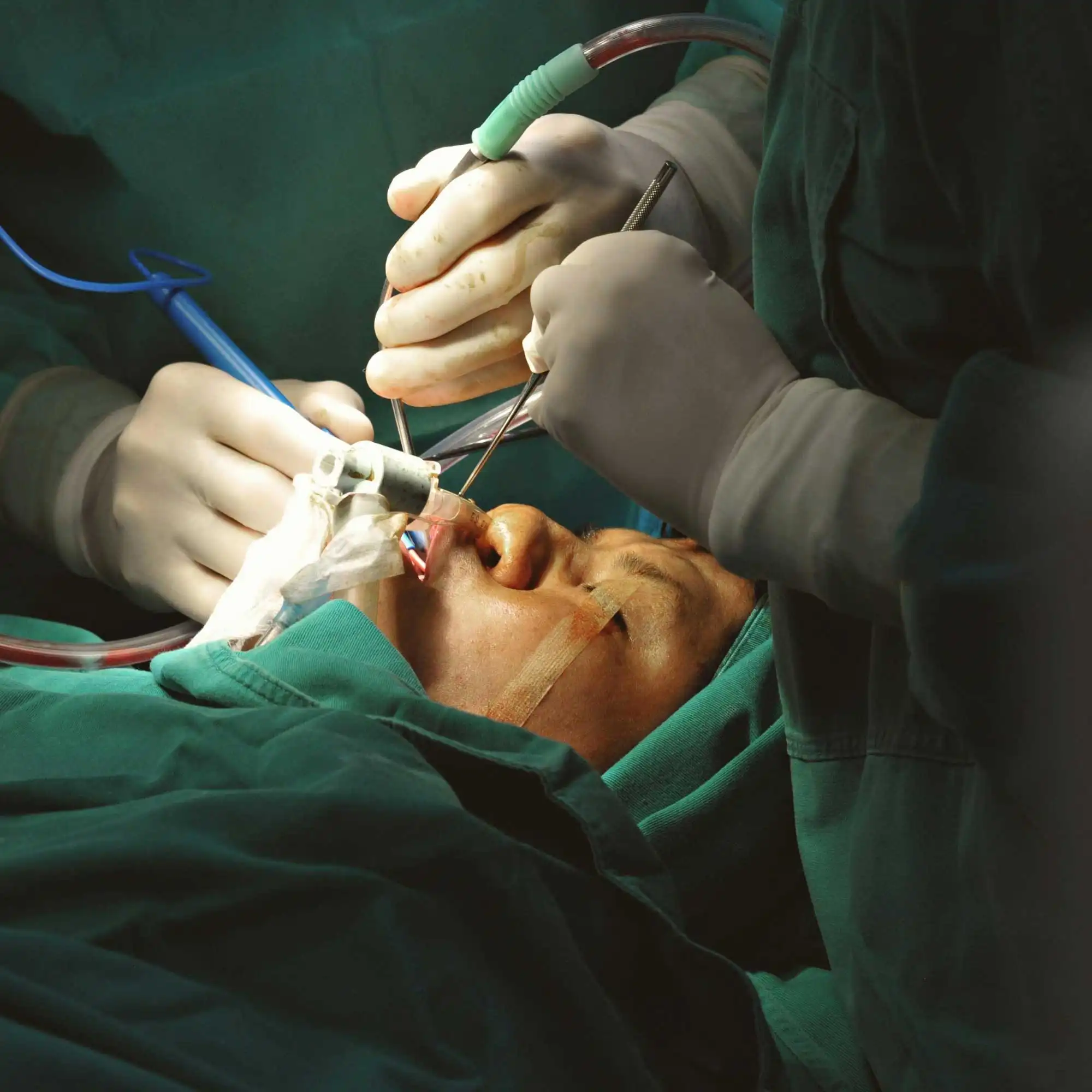 Cirurgias Odontológicas Avançadas