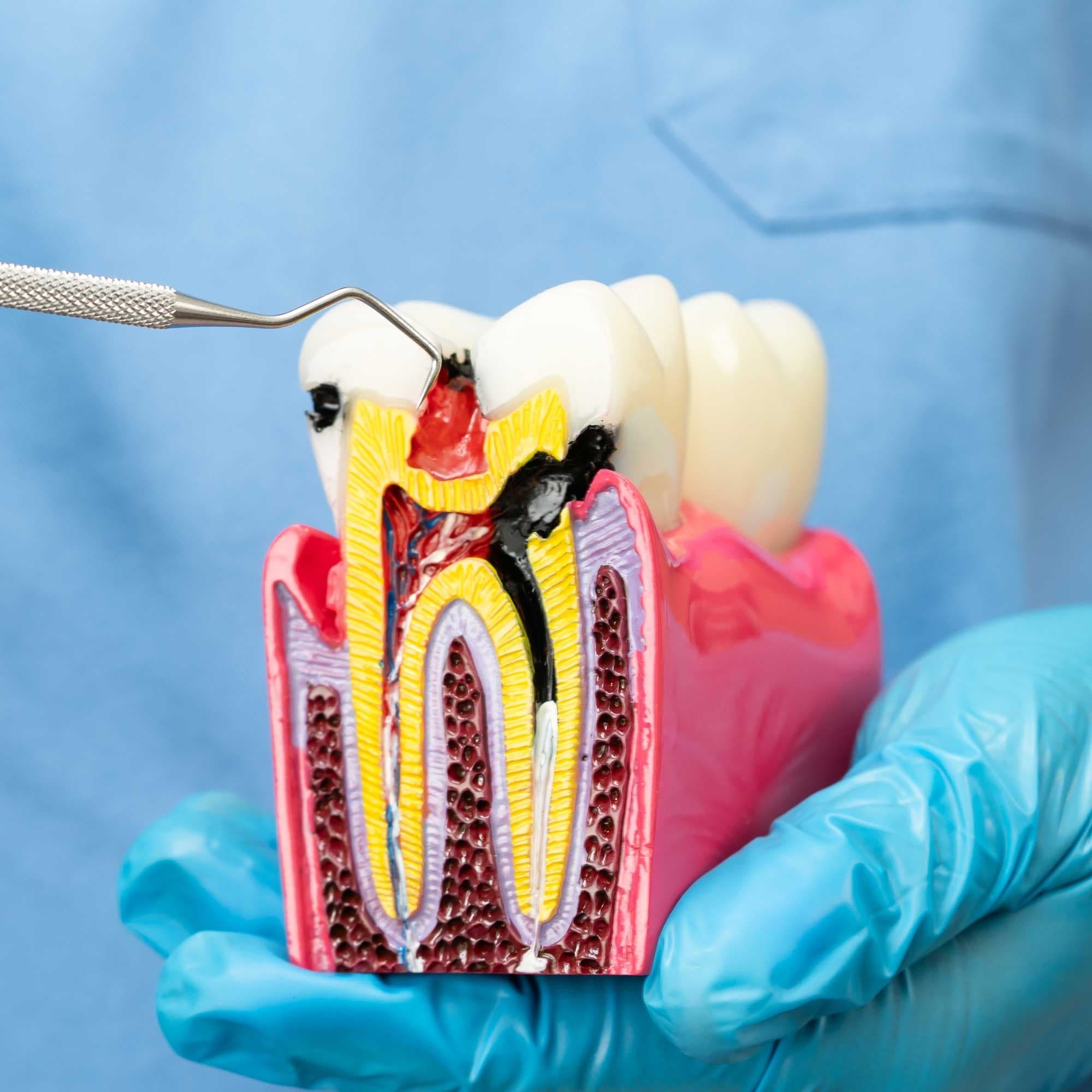 Tratamento de Sequelas Odontológicas